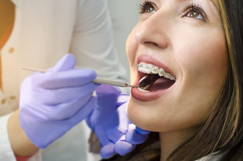 Oral Hygiene For Braces: Our Top Tips