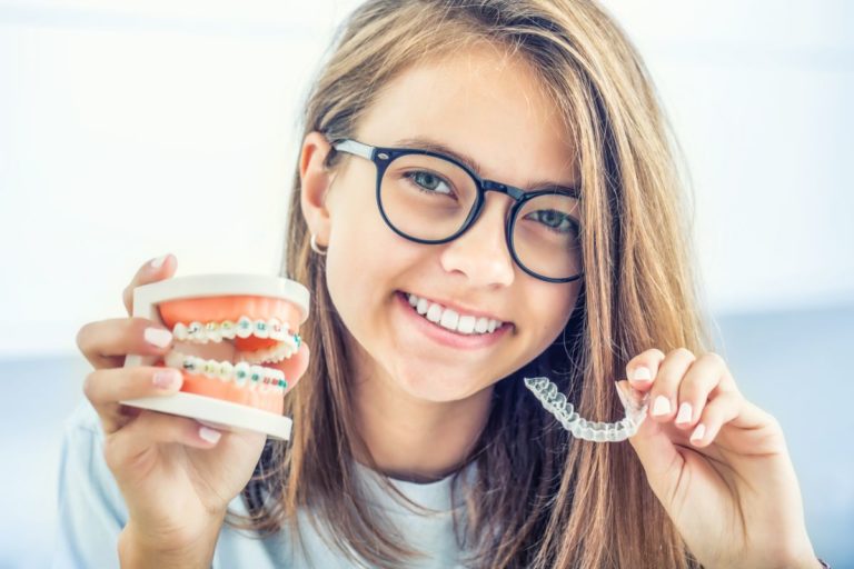 The Different Types of Braces at Gleason Orthodontics