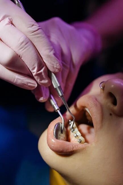 orthodontist webster