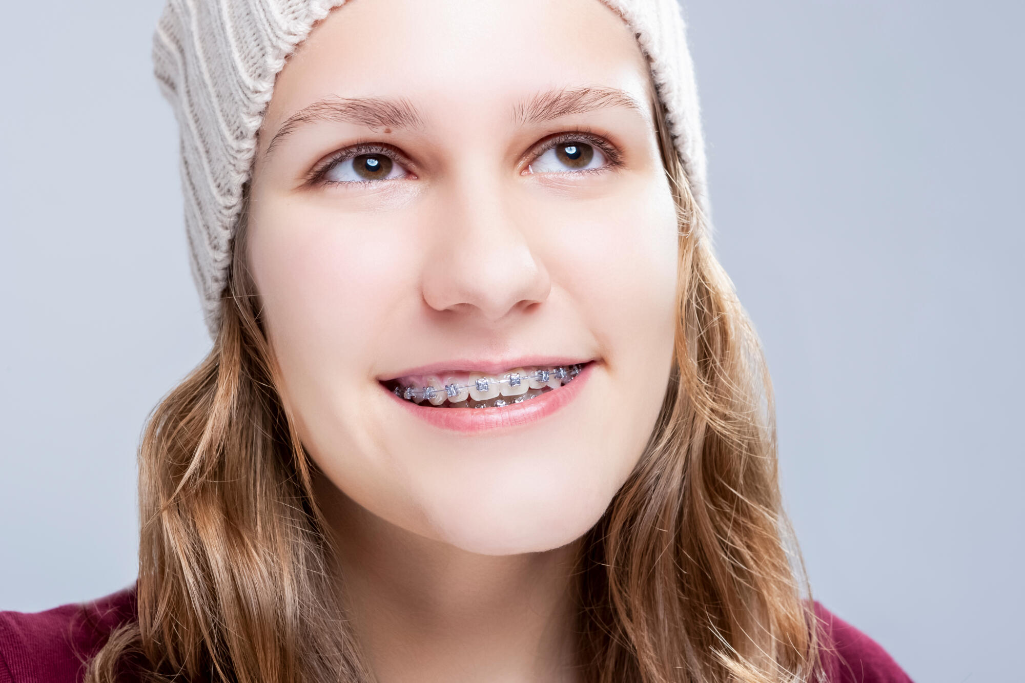 are braces cheaper than invisalign